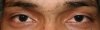 Eyes
