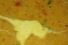 Masoor Dal